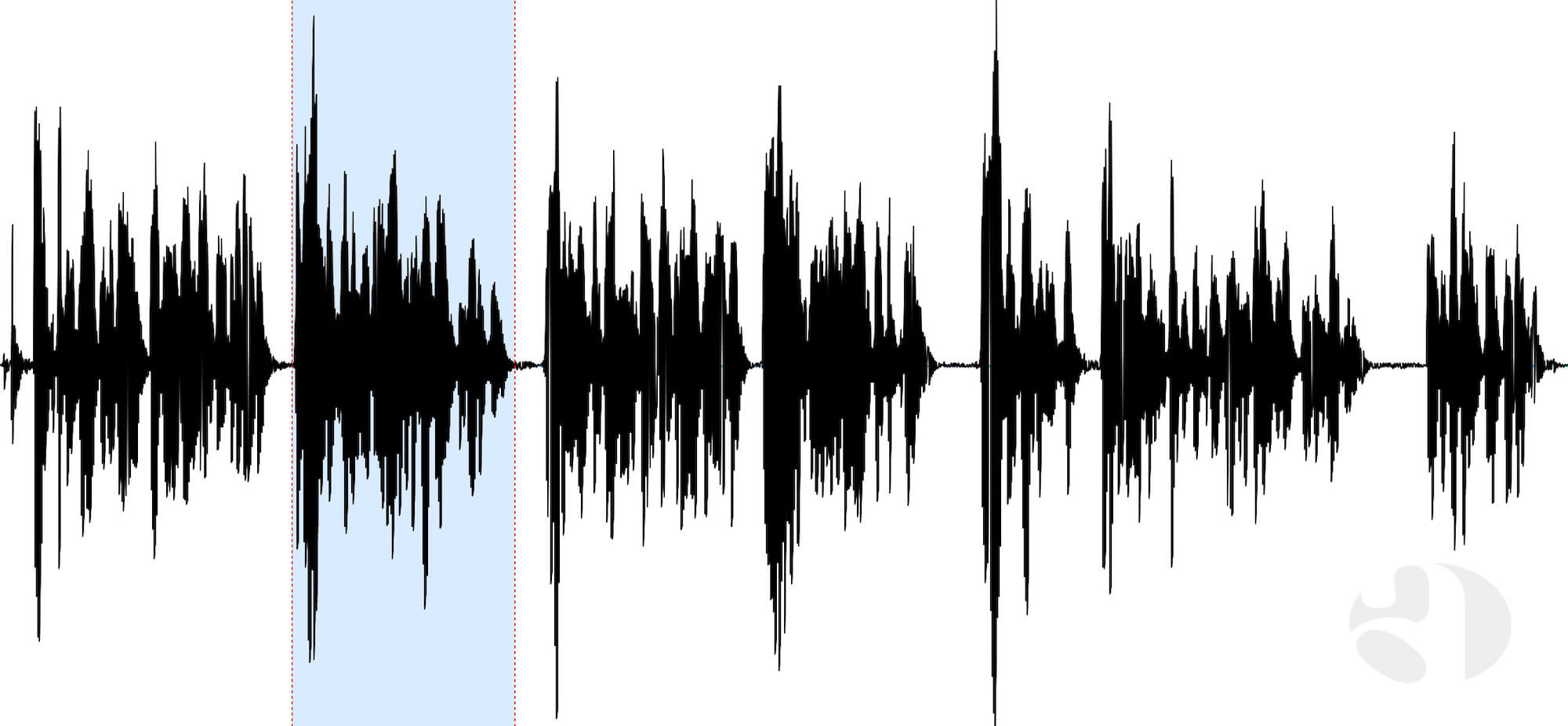 Luftnot beim Sprechen und Singen sind häufig Folge einer schlechten Atemtechnik.